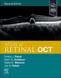 Atlas of Retinal OCT, 2nd Edition Optical Coherence Tomography