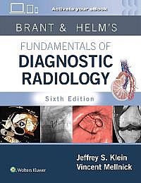 Brant & Helms' Fundamentals of Diagnostic Radiology: Print with Multimedia Sixth edition