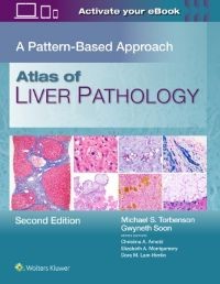  Atlas of Liver Pathology A Pattern-Based Approach, Second edition