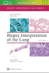 Biopsy Interpretation of the Lung Print with Multimedia, Third edition