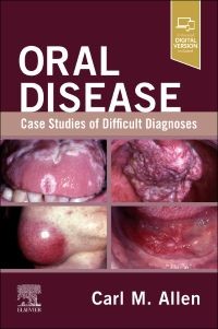 Oral Disease: Case Studies of Difficult Diagnoses, 1st Edition Case Studies of Difficult Diagnoses
