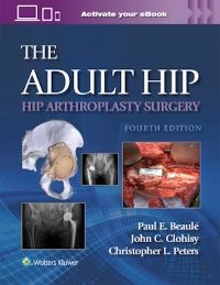  The Adult Hip: Hip Arthroplasty Surgery Print + with Multimedia