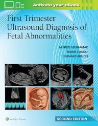 First Trimester Ultrasound Diagnosis of Fetal Abnormalities Second edition
