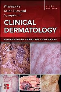IE Fitzpatrick's Color Atlas and Synopsis of Clinical Dermatology, 9/e