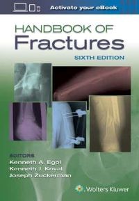 Handbook of Fractures Sixth edition 