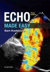 Echo Made Easy, 3rd Edition