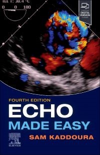 Echo Made Easy, 3rd Edition