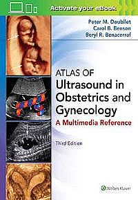 Atlas of Ultrasound in Obstetrics and Gynecology Third edition
