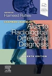 Chapman & Nakielny's Aids to Radiological Differential Diagnosis, 7th Edition