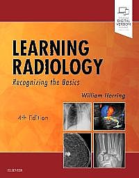 Learning Radiology, 4th Edition Recognizing the Basics