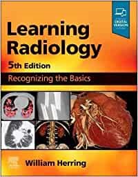 Learning Radiology, 5th Edition Recognizing the Basics 