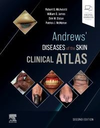 Andrews
